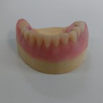 Wax up with framework